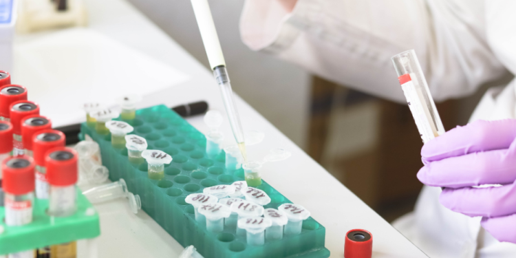 Salud Pública informa que la variante «Frankenstein» del COVID-19 no ha ingresado a Uruguay